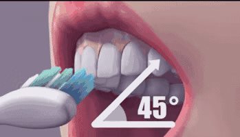 听说牙科医生从不用电动牙刷？跟普通牙刷比，到底哪个好？